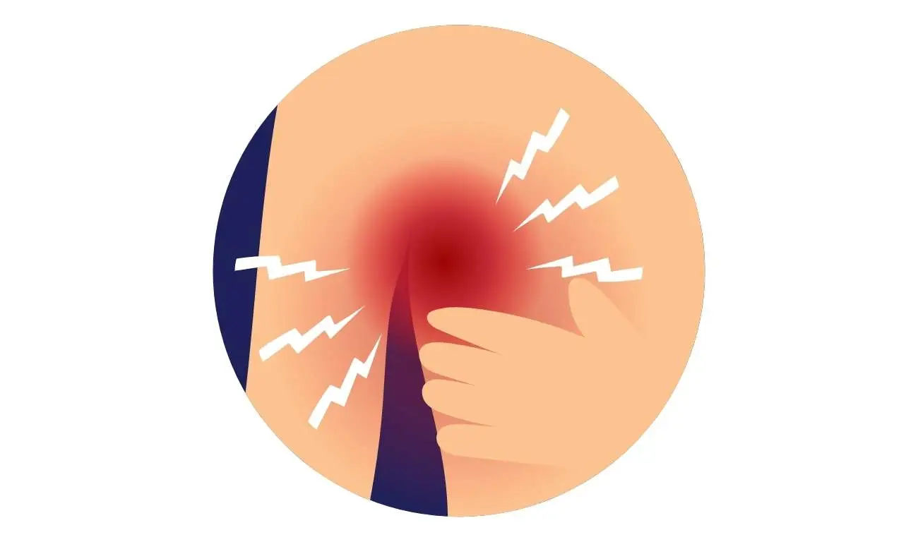 An animation depicting a painful abscess that needs to be drained.