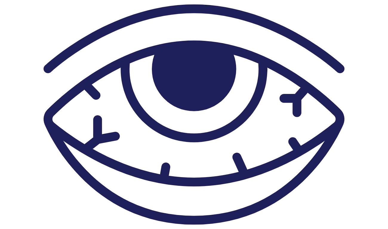 OPT_EyeInfection (1)